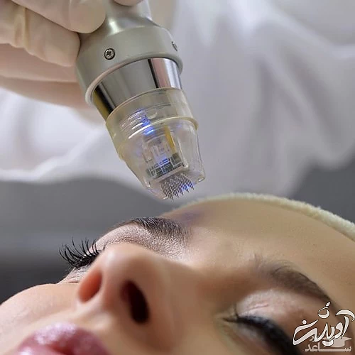 استفاده از آر اف روی صورت